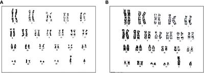 A novel DEAH-box helicase 37 mutation associated with differences of sex development